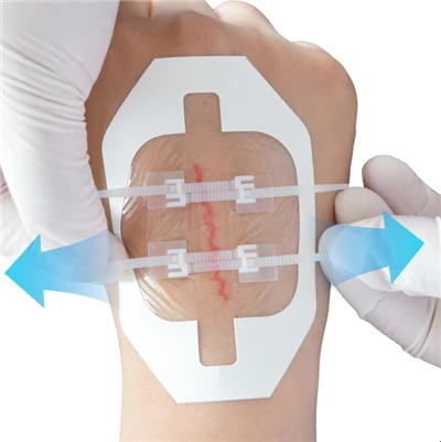 Comment un pansement médical compressif aide-t-il à réduire l'enflure ?